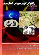 رادیوگرافی و سی تی اسکن ریه